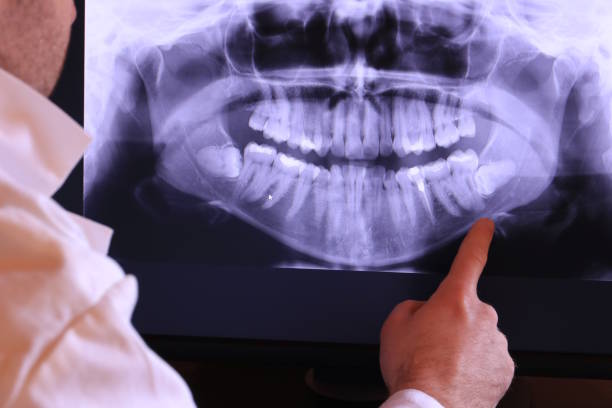 Best 24-Hour Emergency Dentist  in Frazier Park, CA