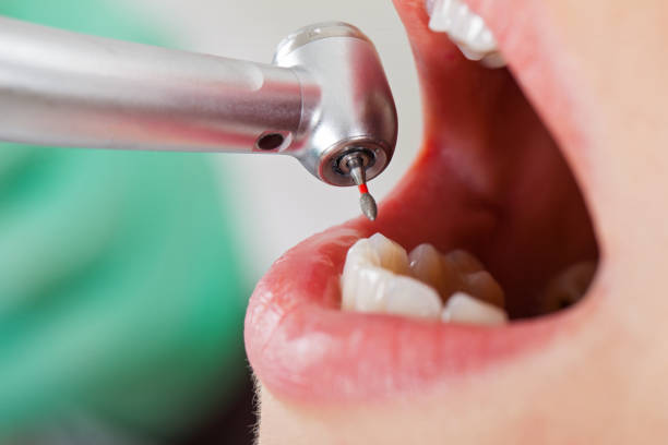 Best Urgent Dental Care  in Frazier Park, CA